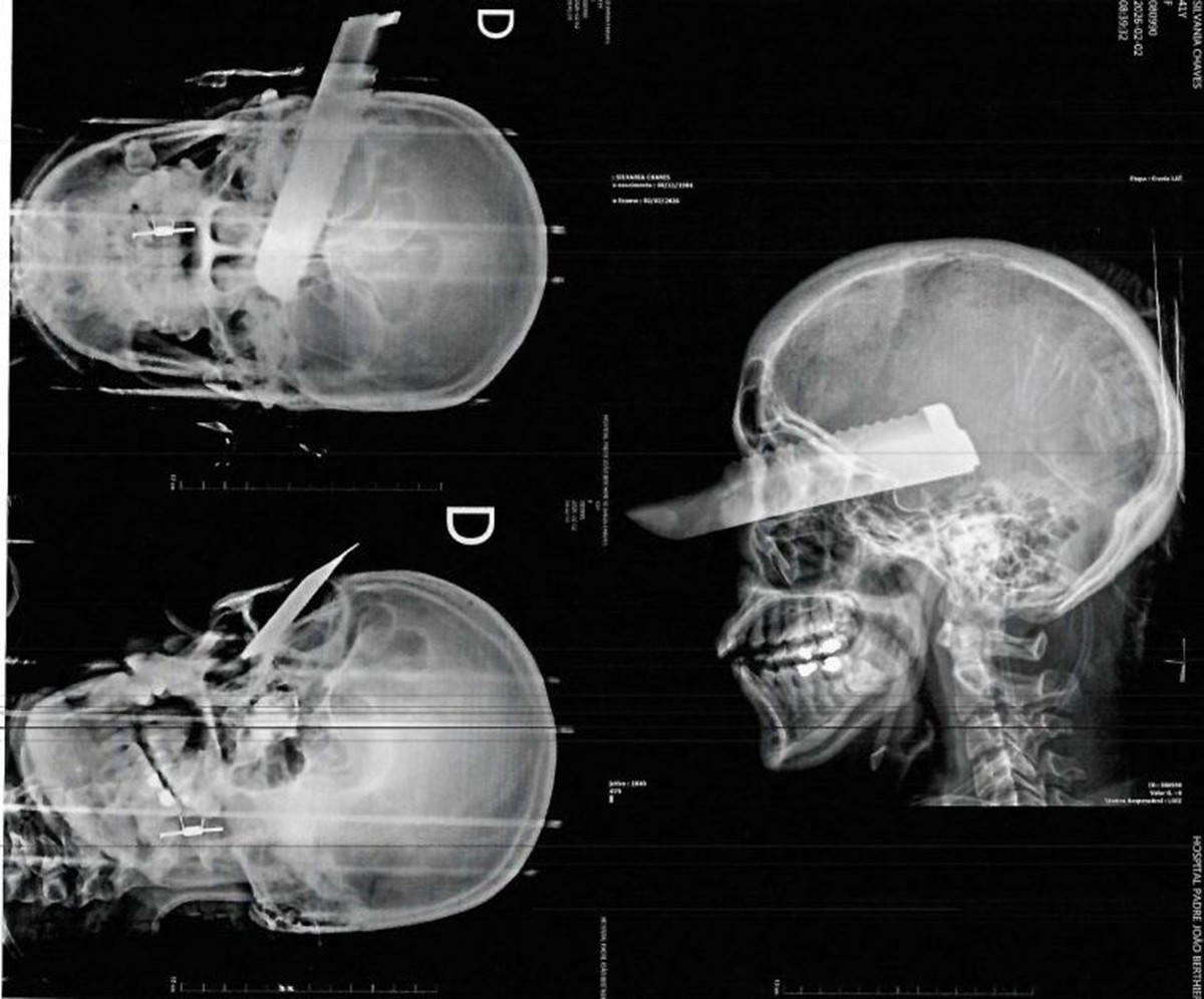 foto Not&iacute;cia Biguaçu